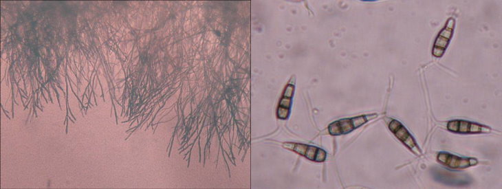 灰斑病菌絲形態及胞子型態