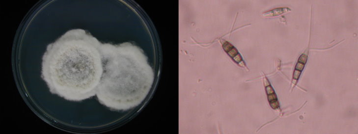 C.病原菌型態及其孢子