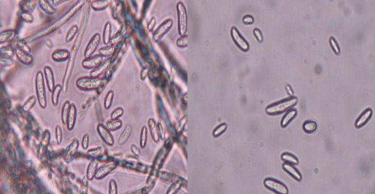 鐮胞菌胞子