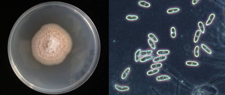 菌落型態：炭疽病病原菌在PDA培養基上之菌落型態及其橢圓形孢子