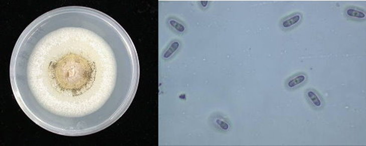 病原菌型態：炭疽病於PDA培養基上之菌落型態，右圖則為其孢子型態。