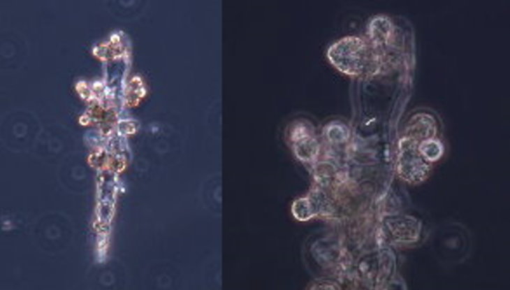 菌絲型態：印度棗輪斑病C. pyramidalis孢子束及其上的疣狀突起。