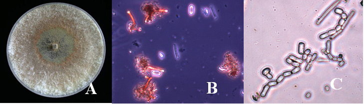 病原菌型態：褐根病在PDA培養基上型態(A)及其鹿角狀菌絲(B)和斷生孢子(C)